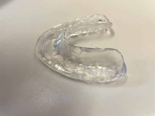 關節性牙骹痛通常由保守治療開始，病人會在晚上戴着咬合夾板（牙膠），以改善顳顎關節症。